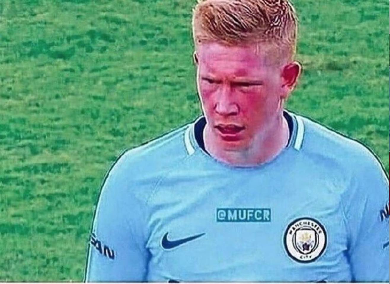 大巴黎官方：舍瓦利耶脚踝受伤接受治疗，杜埃正在恢复阶段